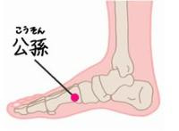 孩子使用艾艾贴有哪些好处